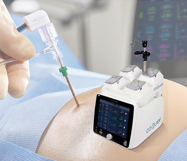 ラジオ波焼灼療法（Coolief* 疼痛管理用高周波システム）のイメージ画像1