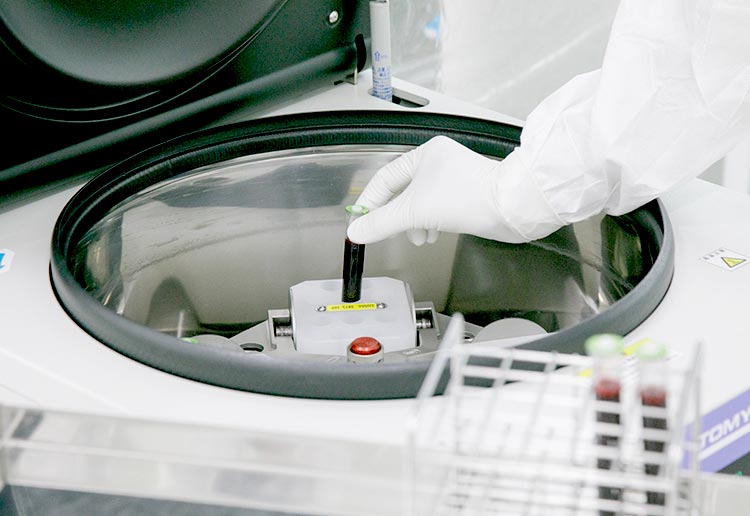 自己血製剤を用いたバイオセラピー（PFC-FD）のイメージ画像